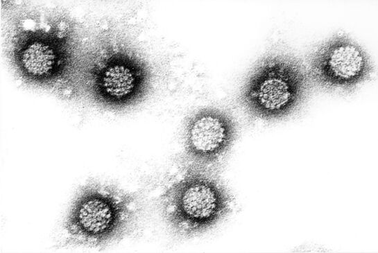 Human papilloma virus